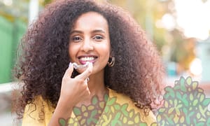 Introduction to Invisalign