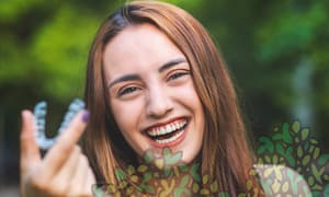 Invisalign treatment process
