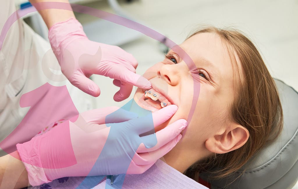 Kids benefit from braces.