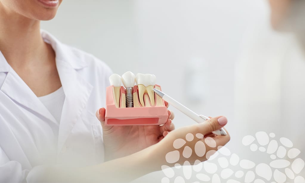 Dental implants restore missing teeth.