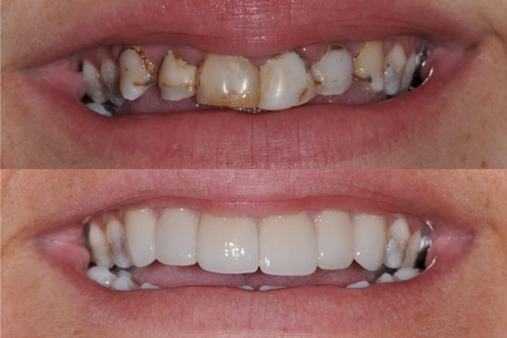 Before and After Kate