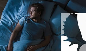 Find out if you'd benefit from a nightguard