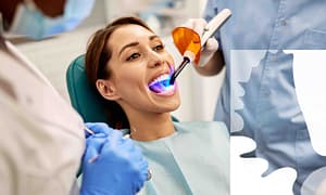 Dental bonding can fix tooth imperfections.
