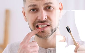 Stop gum disease now.