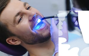 Materials used for dental fillings.