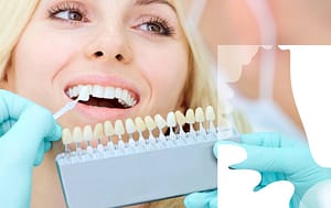 Zirconia crowns vs. traditional crowns