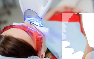 Whiten your teeth for the holidays.