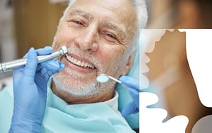 Time to get dentures.