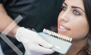 Should you get dental veneers.