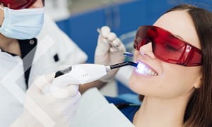 Teeth whitening at the dentist is best.