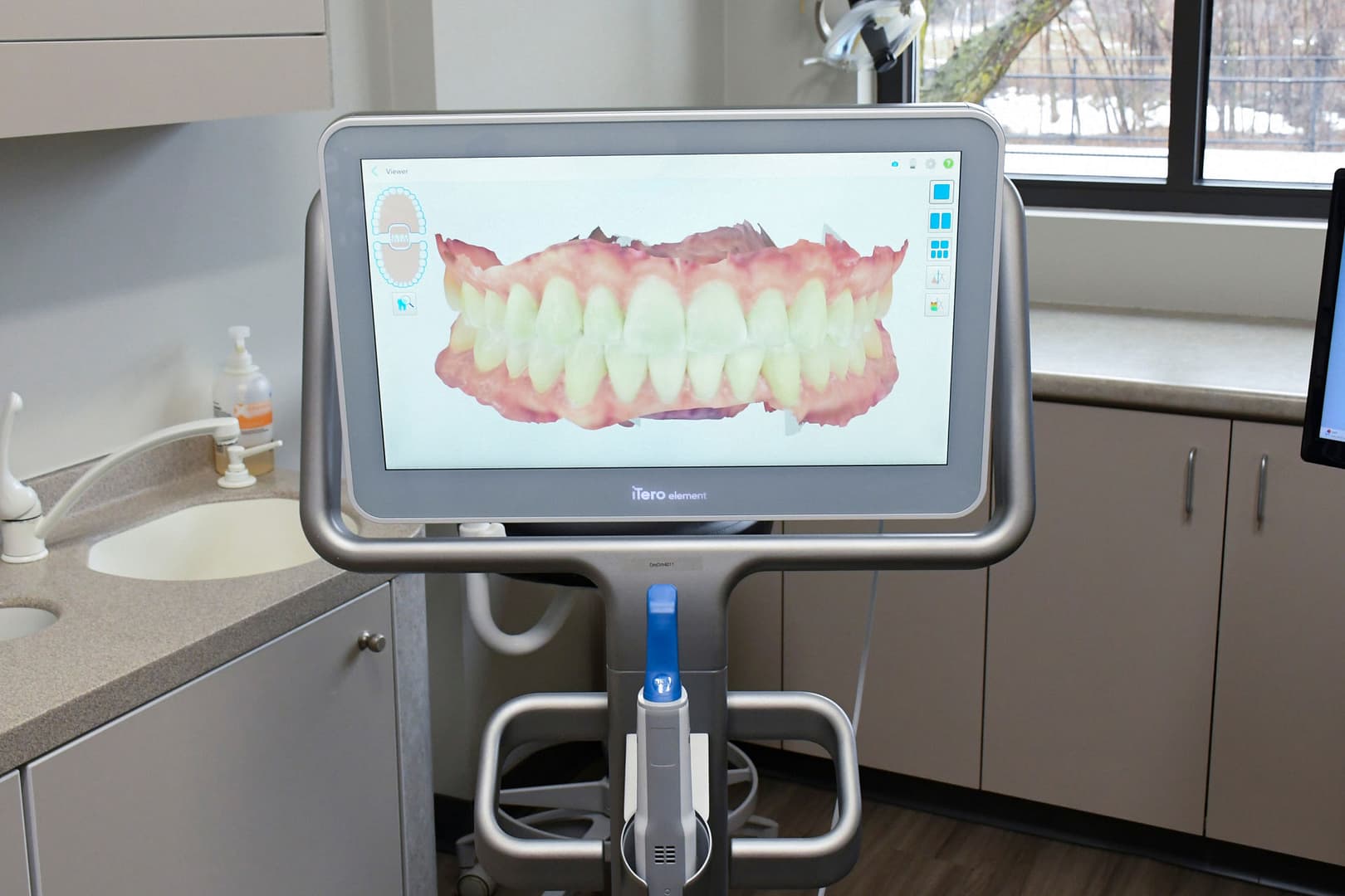 close up of iTero machine in exam room