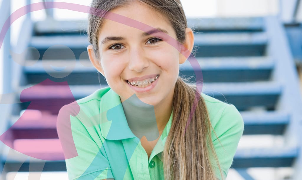 Tooth discoloration after braces