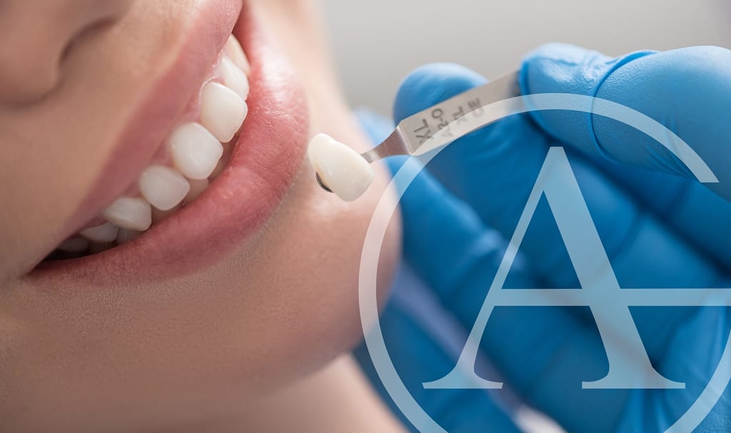 CEREC crowns vs. traditional crowns