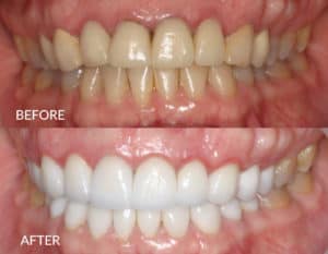 Kimmie Before and After