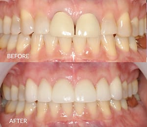 Mona before and after