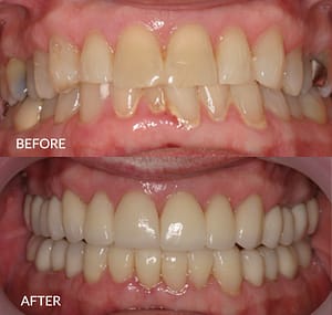 Cloyce before and after