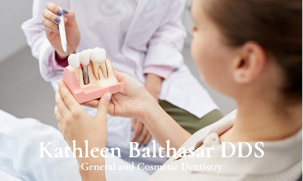 Benefits of dental implants.