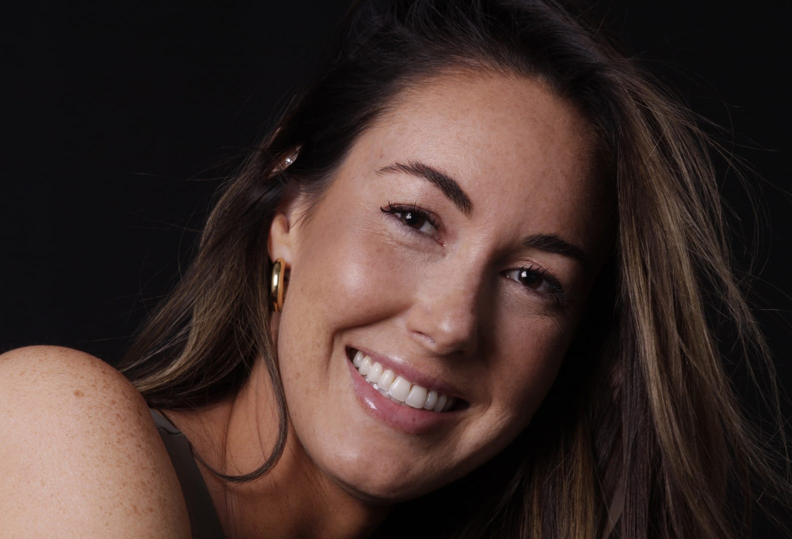 female patient after smile