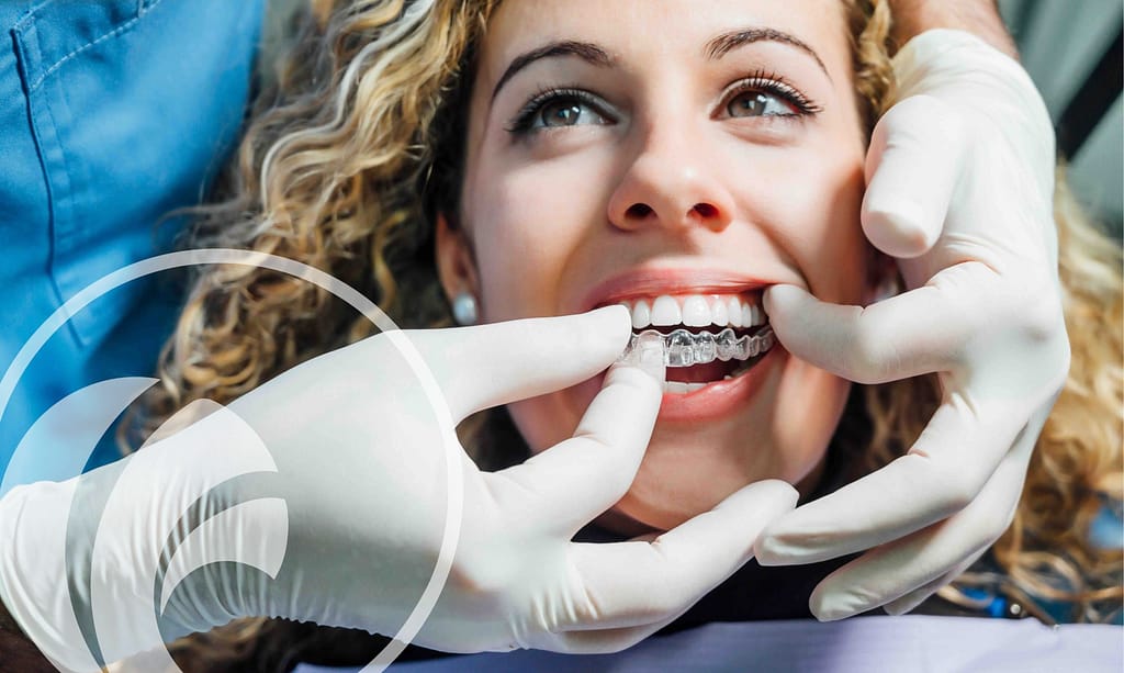 Invisalign Get straight teeth with clear aligners.