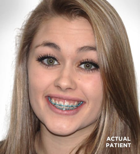 orthodontics