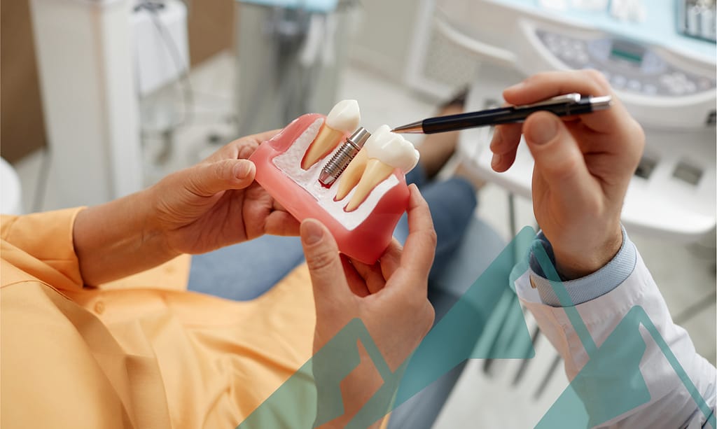 dental-implantguide Your guide to dental implants.