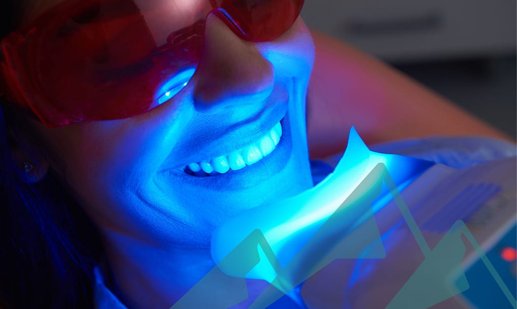 tooth-whitening (3) The truth about tooth whitening.