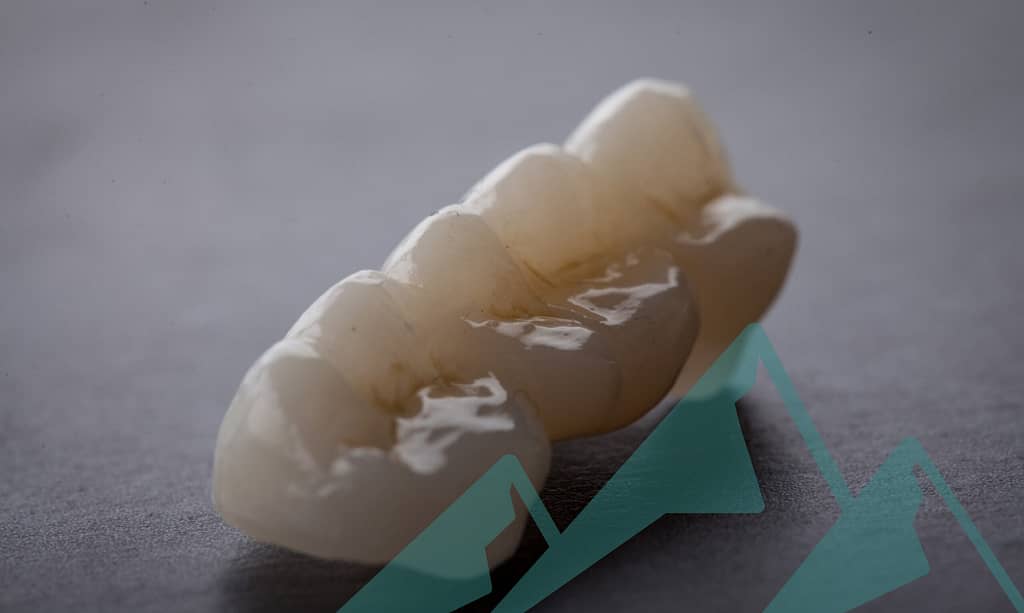 What's an e.Max Crown and Why Do I Need One v2 Why you want an e.max crown.