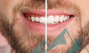 Is gum contouring for you?