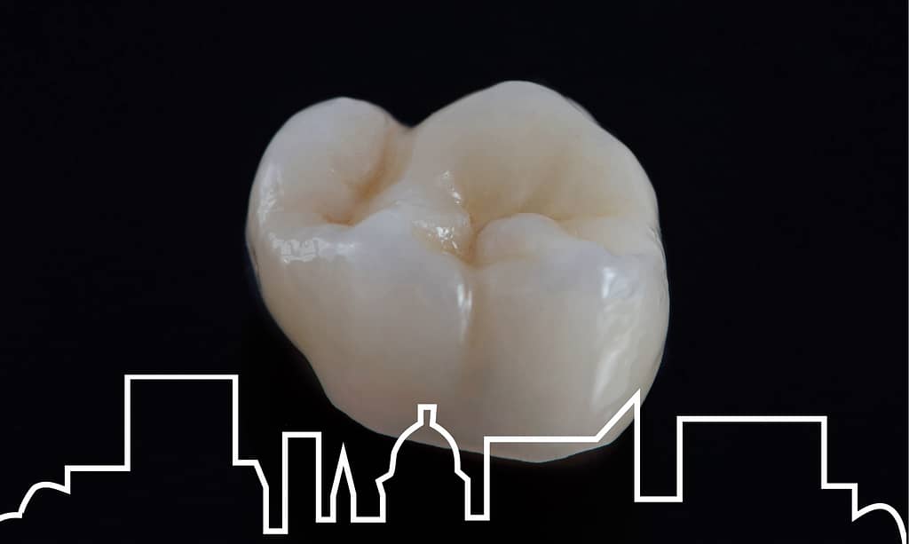 Restore your smile with CEREC crowns.