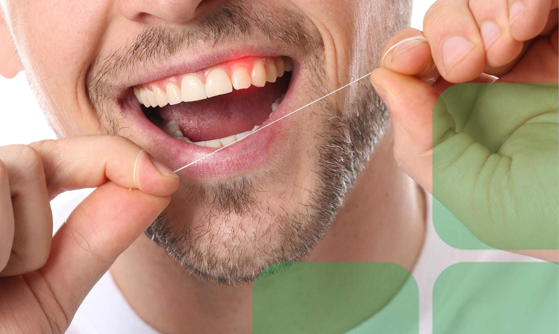 Don't ignore bleeding gums.