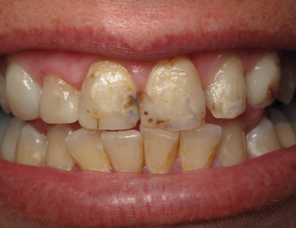 Actual patient before photo