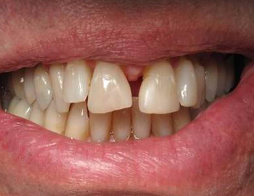 Actual patient before photo