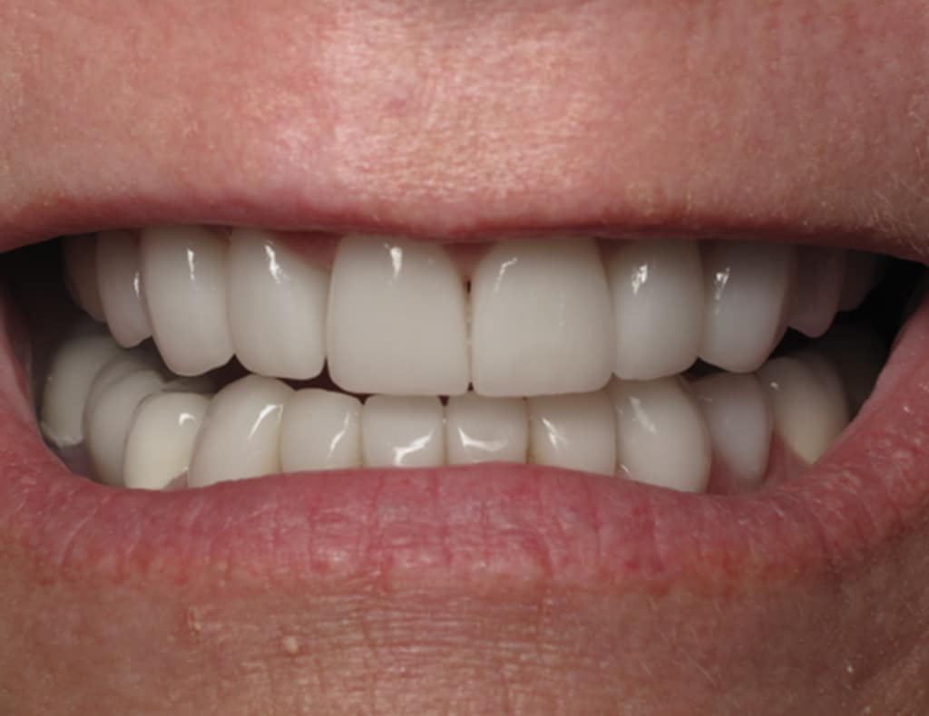 Actual patient after photo