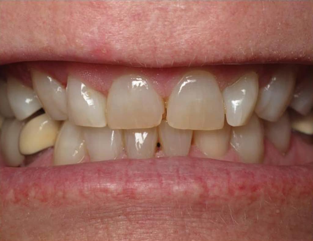 Actual patient before photo