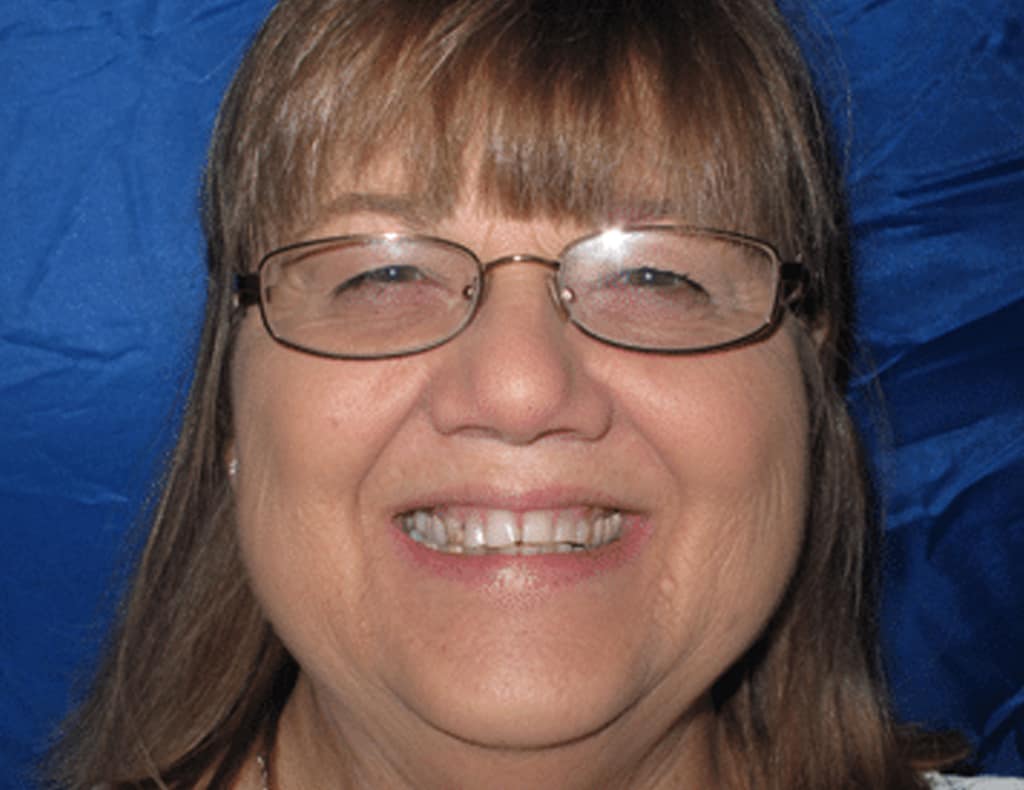 Actual patient before photo