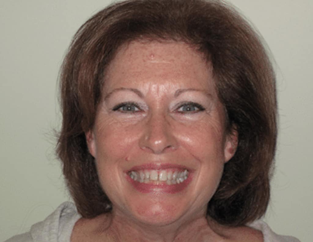 Actual patient before photo