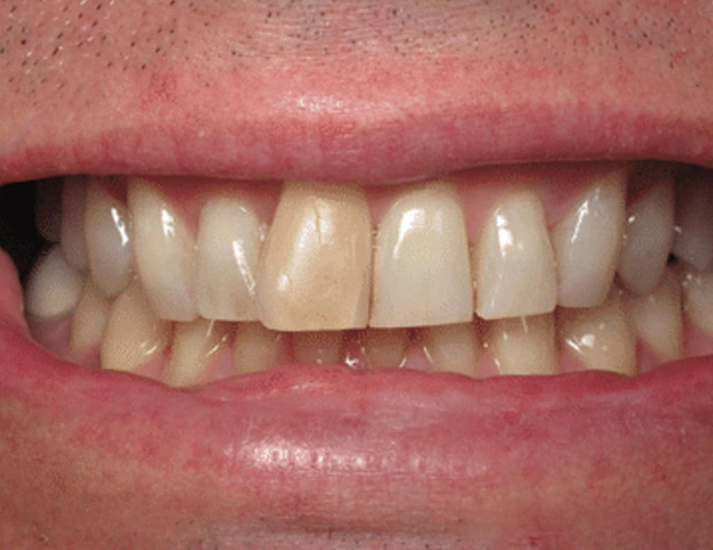 Actual patient before photo