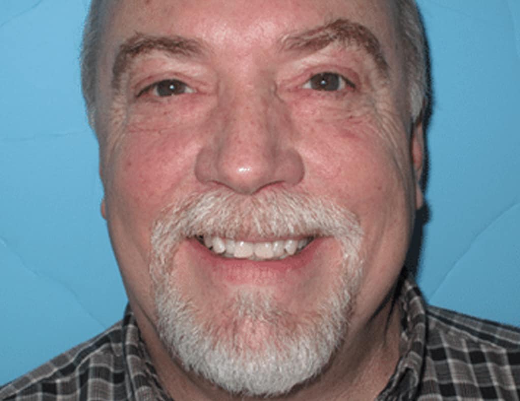 Actual patient before photo