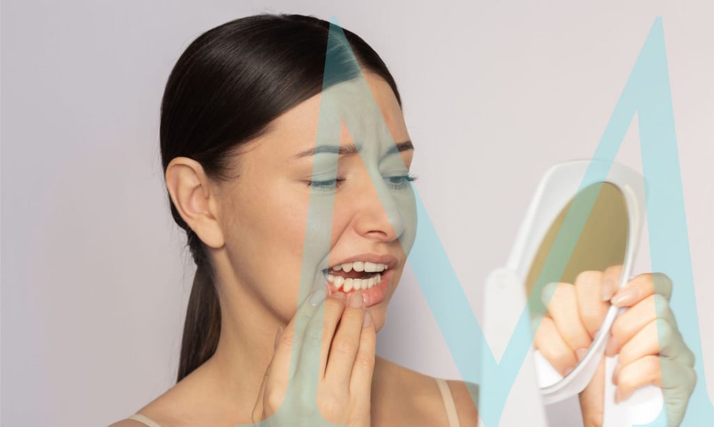 Watch for the signs of gum disease.