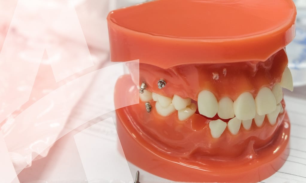 What to know about TADS.