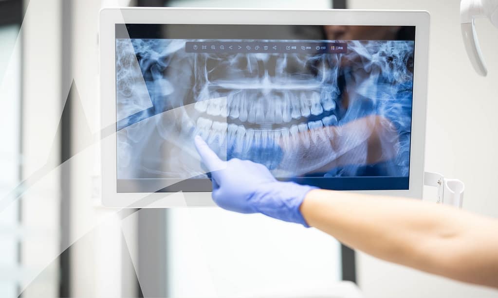 Orthodontic x-rays are pivotal in treatment planning.