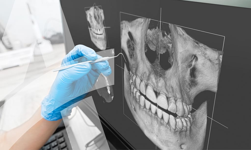 Understand the importance of bone support.