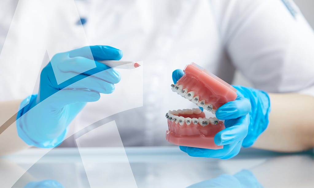 Learn self-ligation and variable force systems.