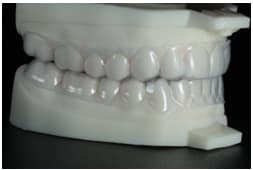 Teeth Whitening Kit New Bern Tennesse