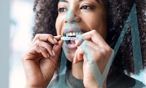 Mouthguards help your bite