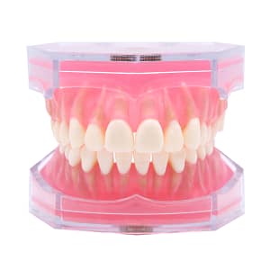 Model with Removeable Teeth