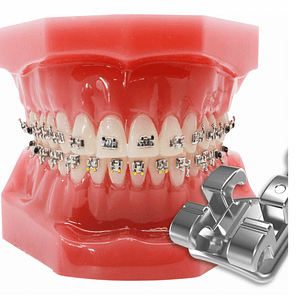 Mini-M Bracket System